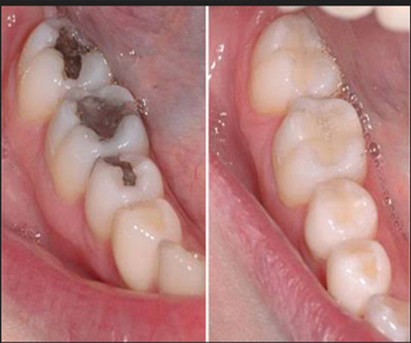 dental clinic Calicut